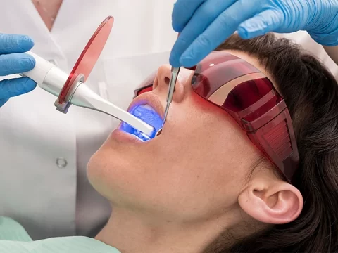 When Bonding a Tooth Is the Best Way to Fix It