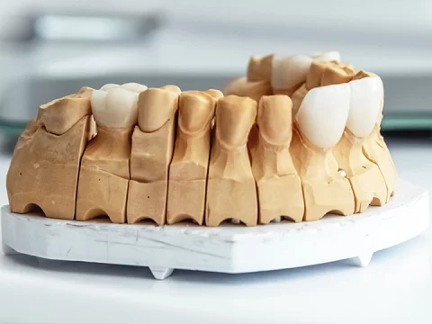 What If Veneers Could Fix That for You?
