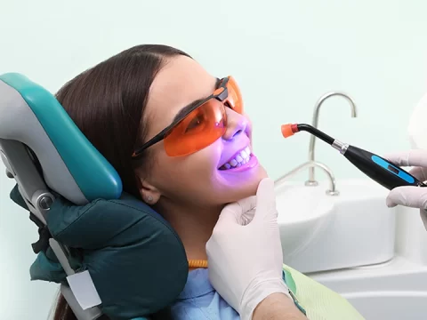 A Few Good Things About Tooth Bonding and Contouring