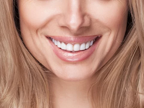Tips to Make Your Teeth-Whitening More Effective